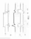 Fig. 05 - Compensation circuit and energy storage device thereof