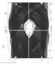 Fig. 05 - Reference-less frequency detector with high jitter tolerance