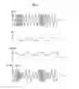 Fig. 03 - FAM TRANSMITTING APPARATUS AND METHOD FOR COMBINING FM SIGNAL AND DIGITAL MODULATED AM SIGNAL
