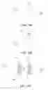 Fig. 10 - Imaging device and method for generating an undistorted wide view image