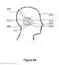 Fig. 05 - Headphone with selectable ambient sound admission