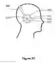 Fig. 07 - Headphone with selectable ambient sound admission