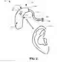 Fig. 03 - Listening device with automatic mode change capabilities