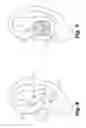 Fig. 06 - Universal earpiece