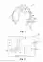 Fig. 02 - Hearing assistance device and method of forming same