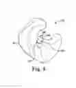 Fig. 05 - Hearing assistance device and method of forming same