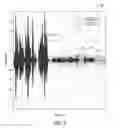 Fig. 07 - Dialog audio signal balancing in an object-based audio program