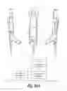 Fig. 16 - Integrated telecommunications handset