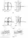Fig. 06 - Determination of beam configuration