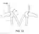 Fig. 11 - Incision making apparatus and incision making method