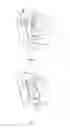 Fig. 11 - System and method for removing a thigh bone from a defeathered whole leg poultry product