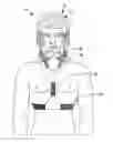 Fig. 01 - Headgear for reducing head trauma