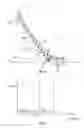 Fig. 05 - Sole structure for an article of footwear having a nonlinear bending stiffness with compression grooves and descending ribs
