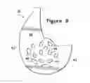 Fig. 09 - Article of footwear incorporating a sole structure with elements having different compressibilities