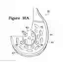 Fig. 15 - Article of footwear incorporating a sole structure with elements having different compressibilities