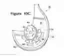 Fig. 17 - Article of footwear incorporating a sole structure with elements having different compressibilities