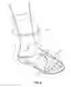 Fig. 05 - Orthopedic Boot Liner