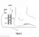 Fig. 03 - Shoe insert