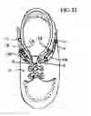 Fig. 13 - Lace ratchet fastening device