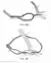 Fig. 13 - Raised Bow Construction and Method