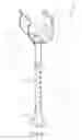 Fig. 02 - Anti-Fatigue Brace Device