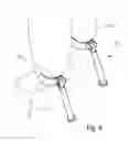 Fig. 06 - Anti-Fatigue Brace Device