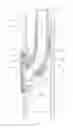 Fig. 06 - Hose valve apparatus and method for retractable hose vacuum systems
