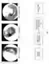 Fig. 02 - Plenoptic otoscope