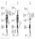 Fig. 04 - Plenoptic otoscope