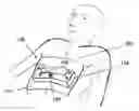 Fig. 01 - Rapid laparoscopy exchange system and method of use thereof