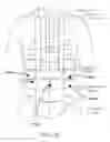 Fig. 06 - Rapid laparoscopy exchange system and method of use thereof