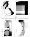 Fig. 26 - Medical interfaces and other medical devices, systems, and methods for performing eye exams