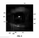 Fig. 06 - System and method for determining corrective vision