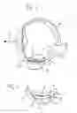 Fig. 02 - IMPLANT FOR DETERMINING INTRAOCULAR PRESSURE
