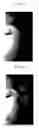 Fig. 05 - Wrinkle measurement apparatus and wrinkle measurement method