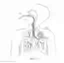Fig. 12 - Functional assessment and treatment catheters and methods for their use in the lung