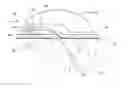 Fig. 01 - Medical sensor assembly