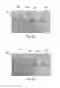 Fig. 09 - Extended balloon assembly for a catheter