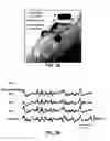 Fig. 09 - Bioresorbable silicon electronics for transient implants