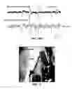 Fig. 28 - Bioresorbable silicon electronics for transient implants