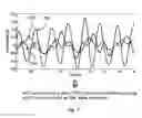Fig. 06 - Device and method for removing artifacts in physiological measurements