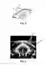 Fig. 03 - Method and device for functional imaging of the brain
