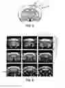 Fig. 04 - Method and device for functional imaging of the brain