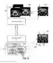 Fig. 05 - Method and device for functional imaging of the brain