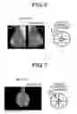 Fig. 05 - Medical image-processing apparatus and ultrasonic diagnostic device