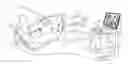 Fig. 01 - Endobronchial catheter