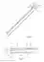 Fig. 03 - Endobronchial catheter