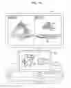 Fig. 11 - Ultrasound diagnosis apparatus and method of operating the same