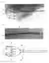 Fig. 02 - Vagina evaluation device and uterus evaluation device