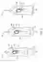 Fig. 06 - Biopsy device arming mechanism